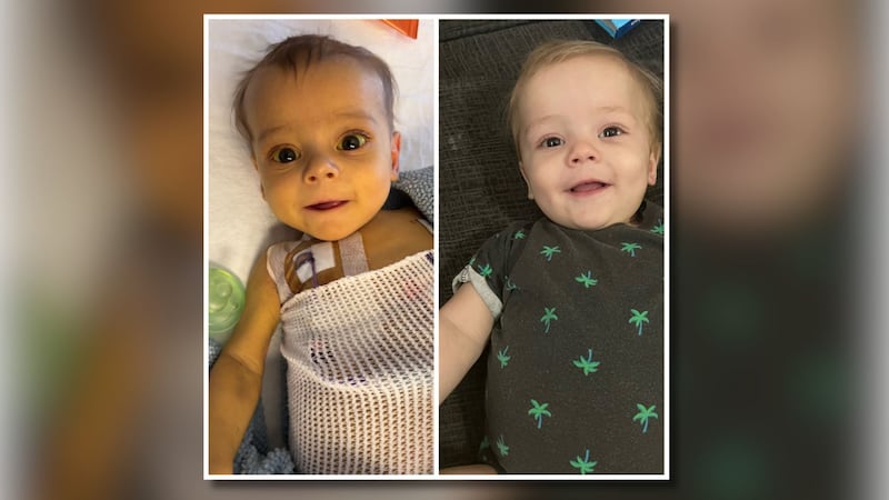 Before and after photos of Xander Sullivan.