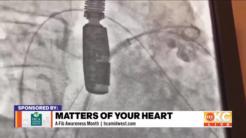 September is National Atrial Fibrillation Awareness Month and our friends at HCA Midwest...