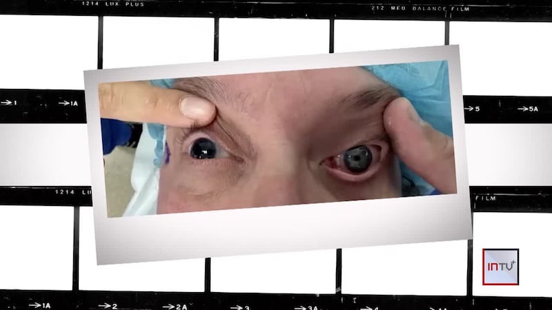 Woman regains sight after first-of-its-kind surgery using new implant