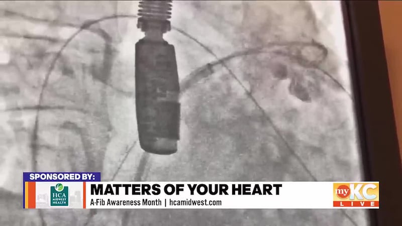 September is National Atrial Fibrillation Awareness Month and our friends at HCA Midwest...