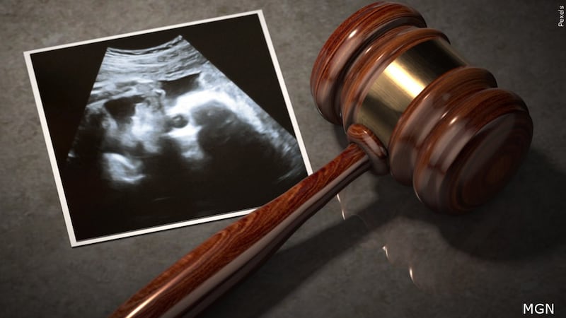FILE — Kansas will start a divorced or single parent’s obligation to pay child support “from...